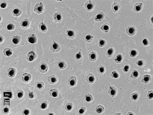 顯微鏡底下的象牙質管道